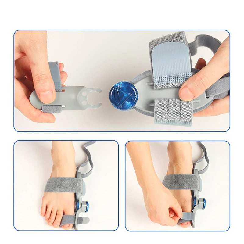 Adjustable Bunion Corrector with Rotating Toe Separator – Unisex Foot Alignment Brace for Hallux Valgus Relief