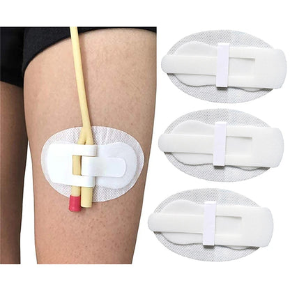 Urinary Clip Securement Legband, Catheter Holder Tube Sticker, Fixation Drainage Anchor Stabilizer, Tape Fixing